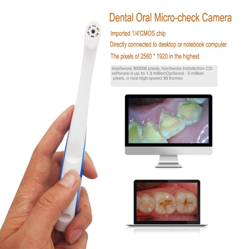 USB Dental Camera Wireless Int - Photography Lighting Patterns avis et prix