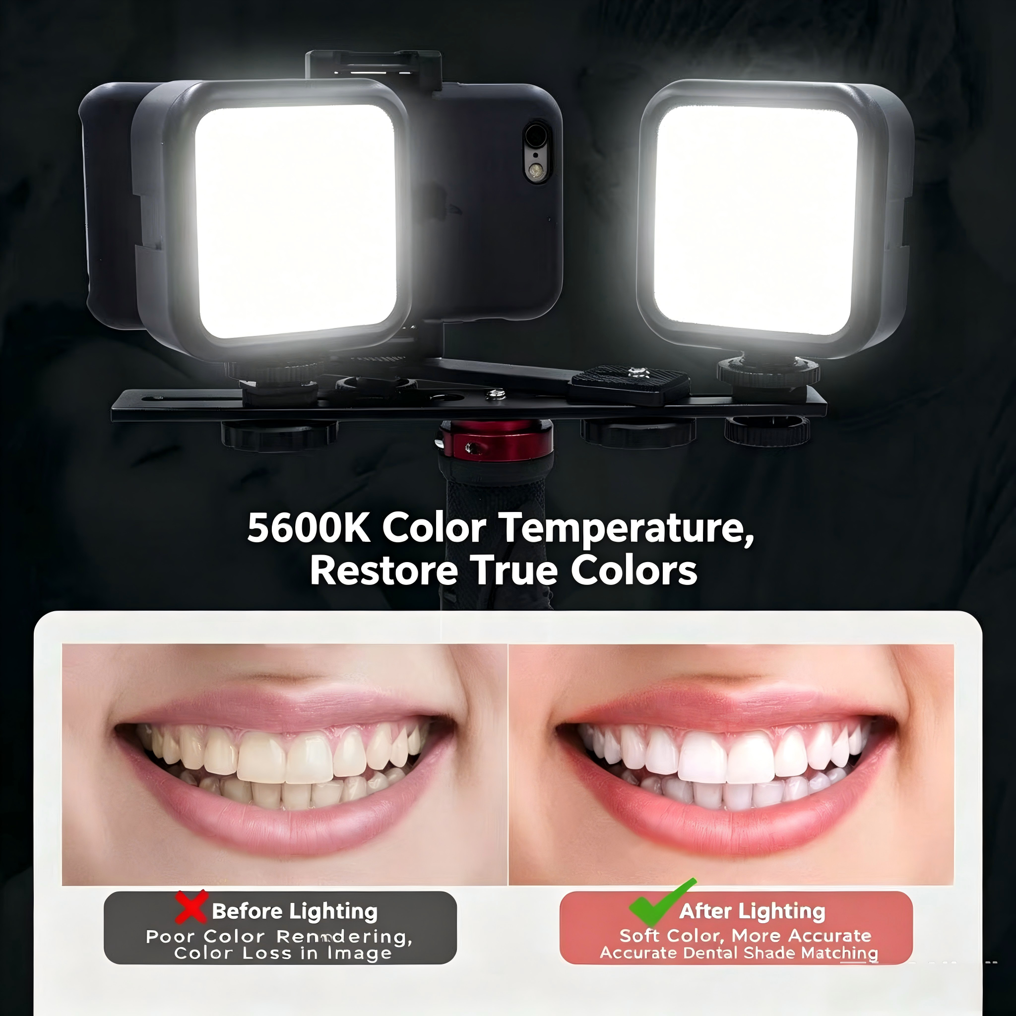 Portable Dental Photography Li - Photography Lighting Basics avis et prix